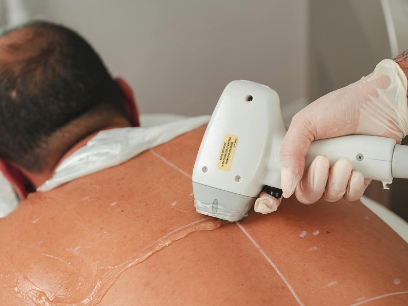 Laser Therapy